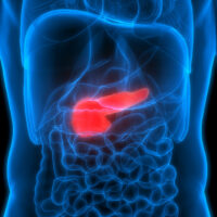 5 Lifestyle Tips to Prevent Pancreatic Cancer