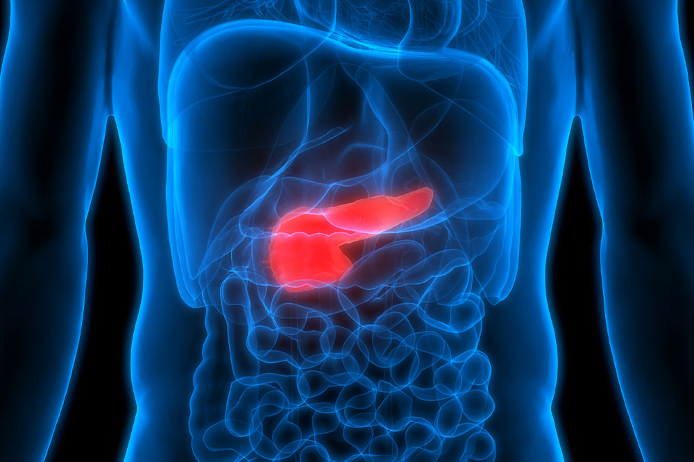 5 Lifestyle Tips to Prevent Pancreatic Cancer